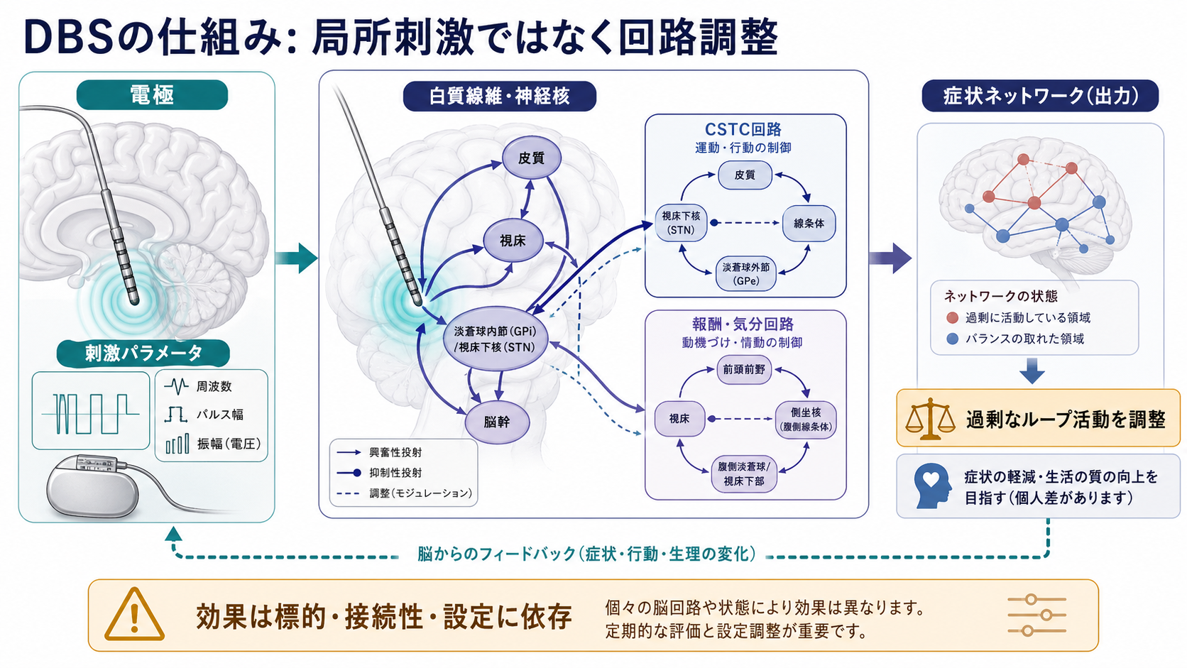 DBSは局所刺激ではなく回路調整として働く