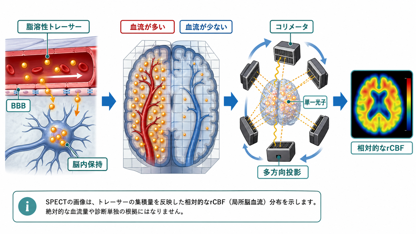 SPECTで脳血流が画像になる仕組み