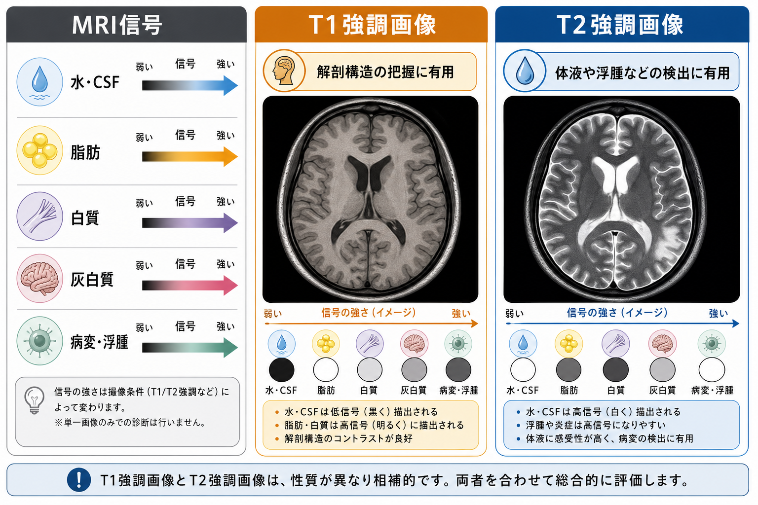 T1強調画像とT2強調画像の概念地図