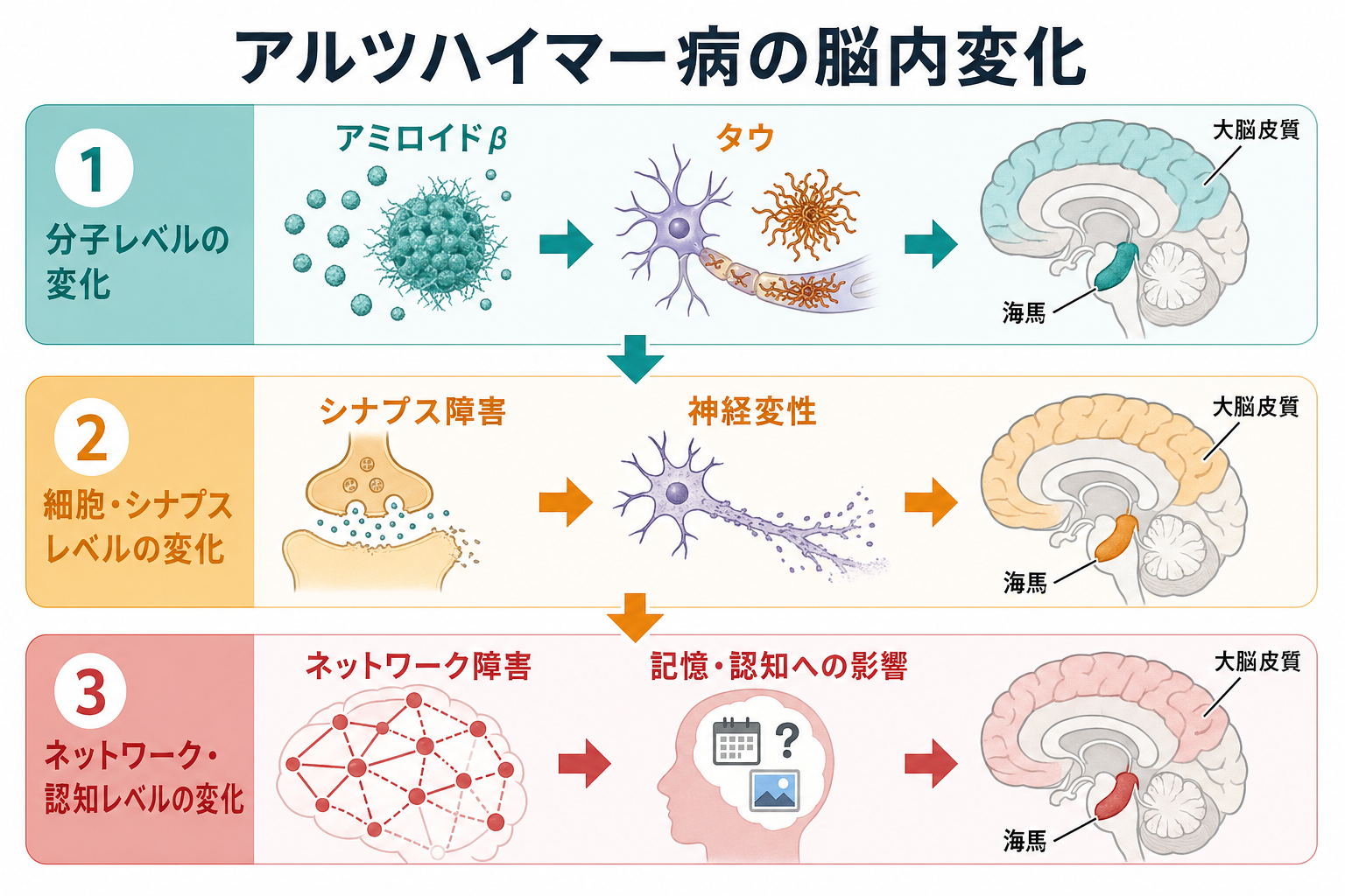 アルツハイマー病の脳内変化の概念地図