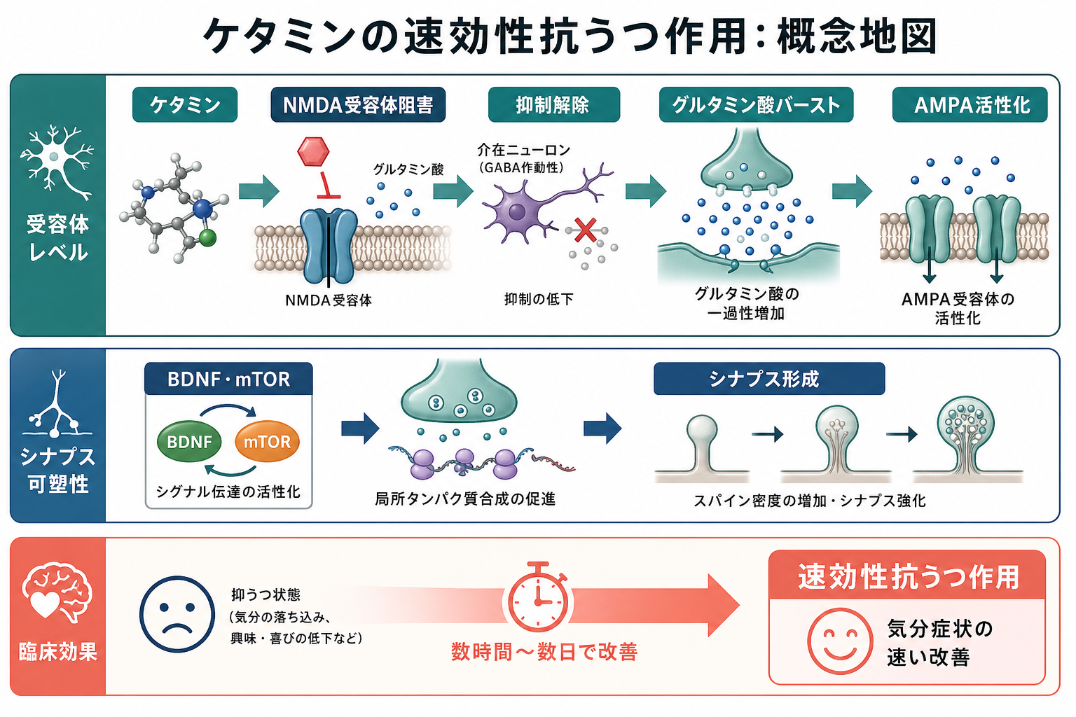 ケタミン速効性抗うつ作用の概念地図