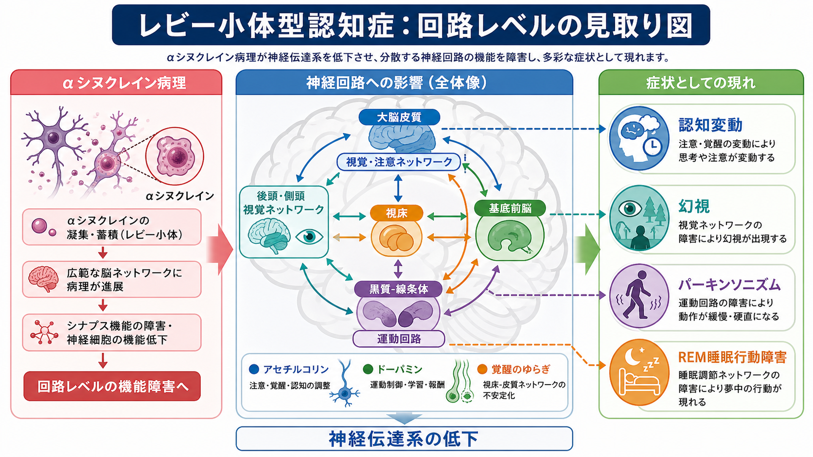 レビー小体型認知症の神経回路への影響の全体像