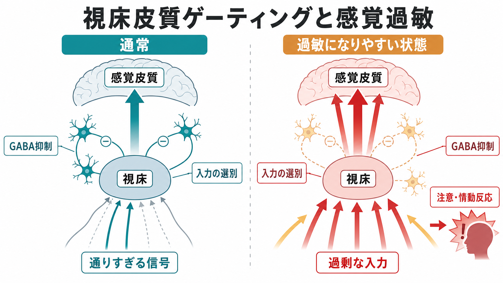 視床皮質ゲーティングと感覚過敏