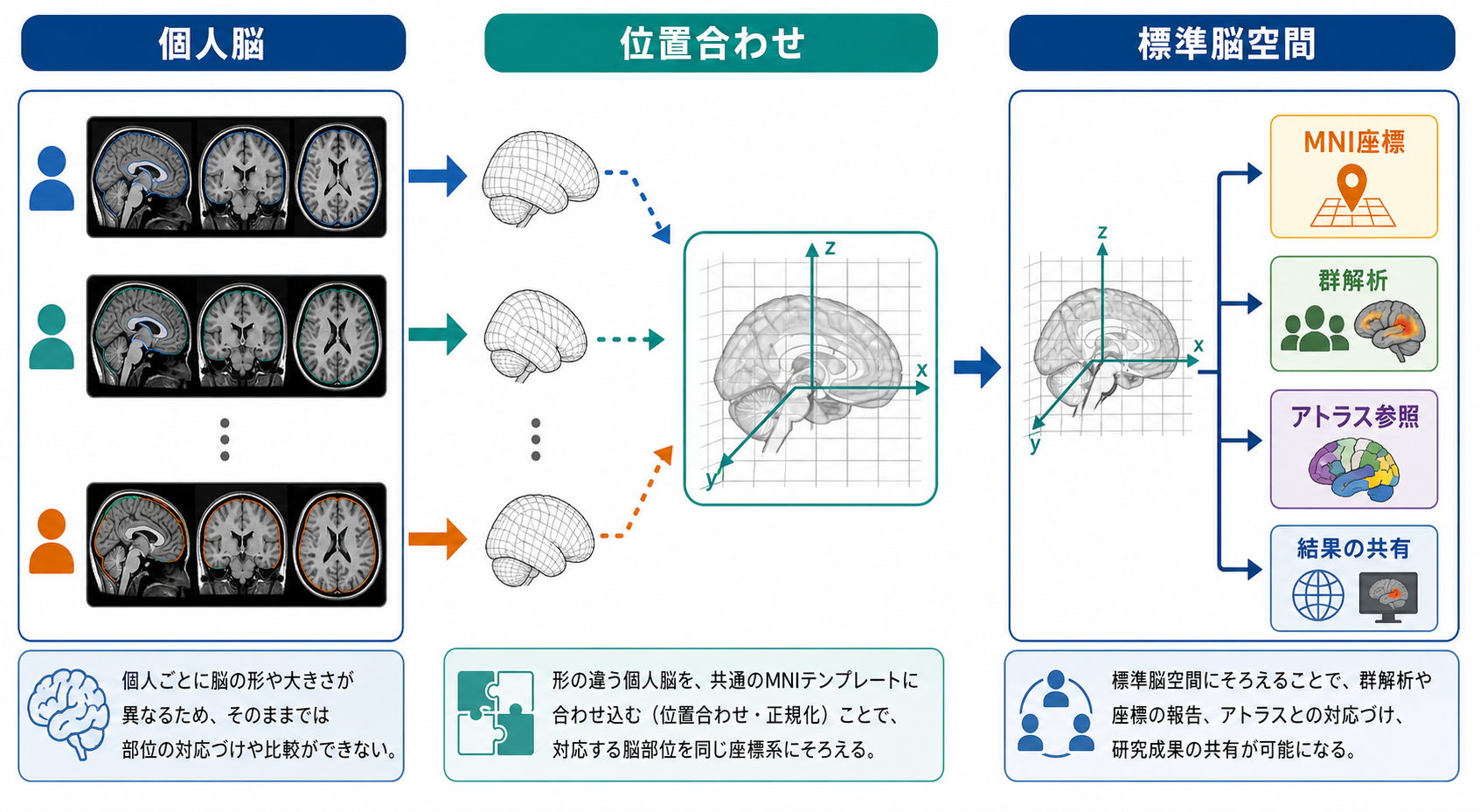 個人脳を標準脳空間にそろえる概念図