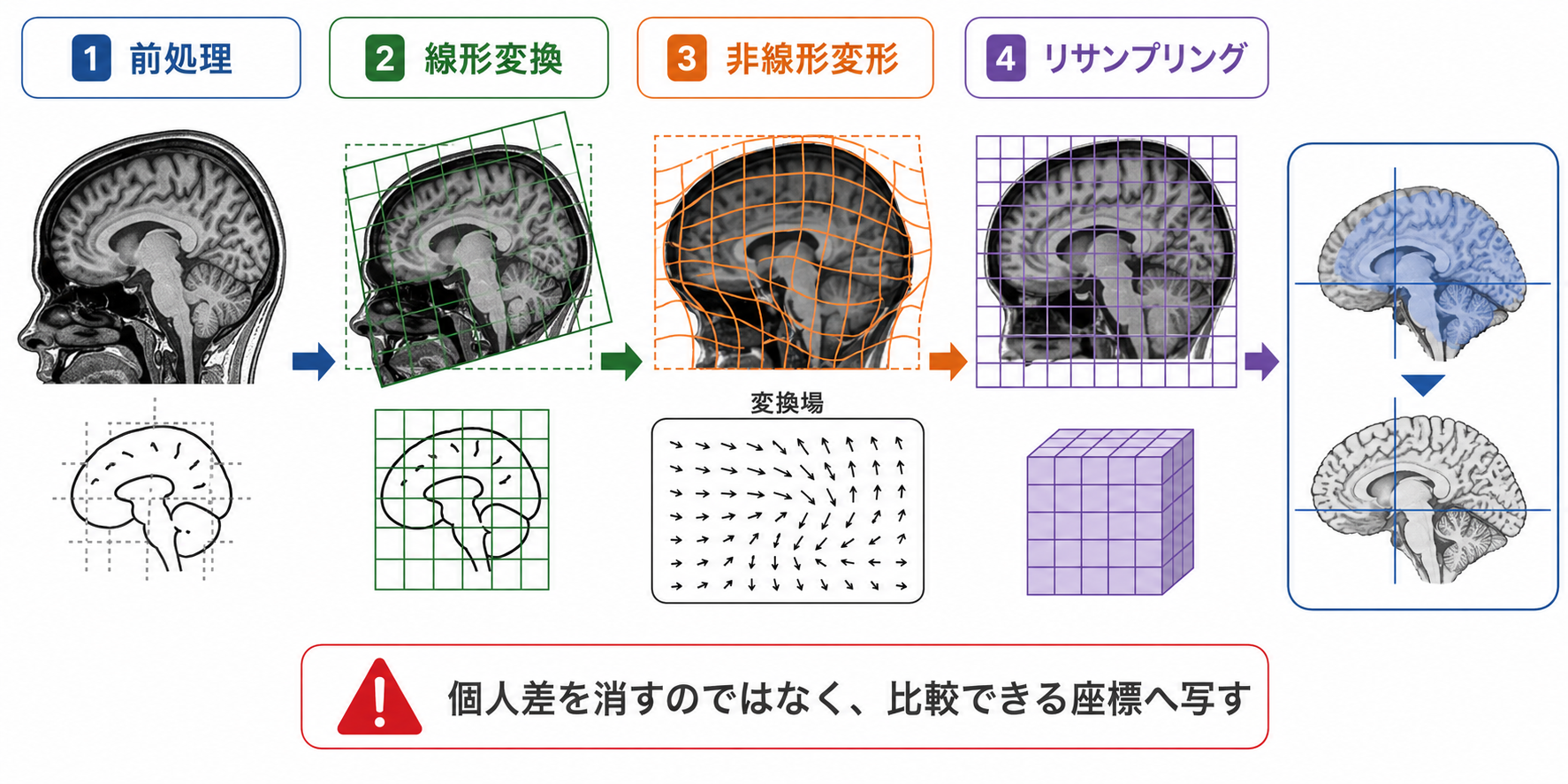 標準脳空間への位置合わせメカニズム