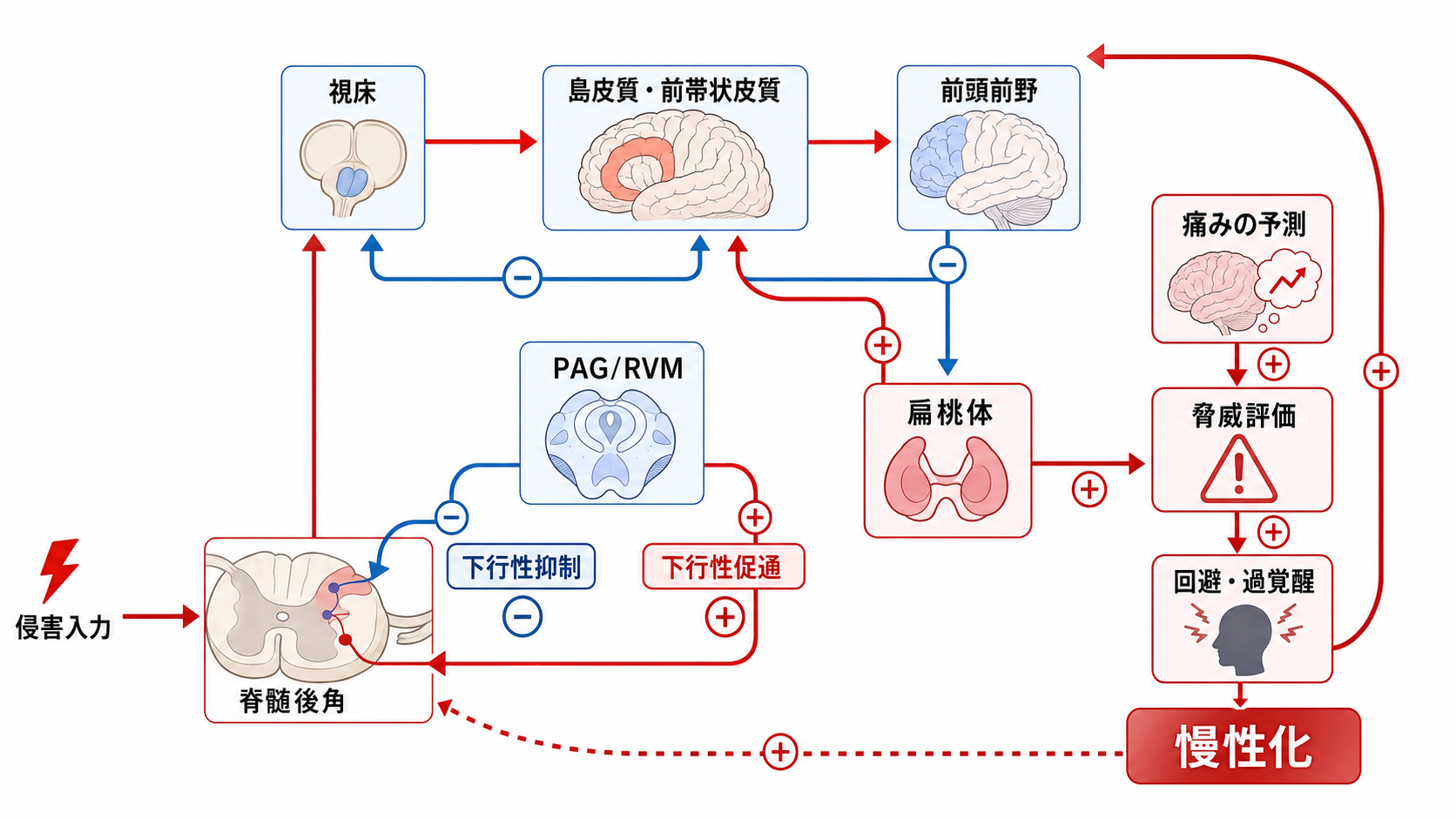 慢性疼痛と情動・注意・報酬系の接続
