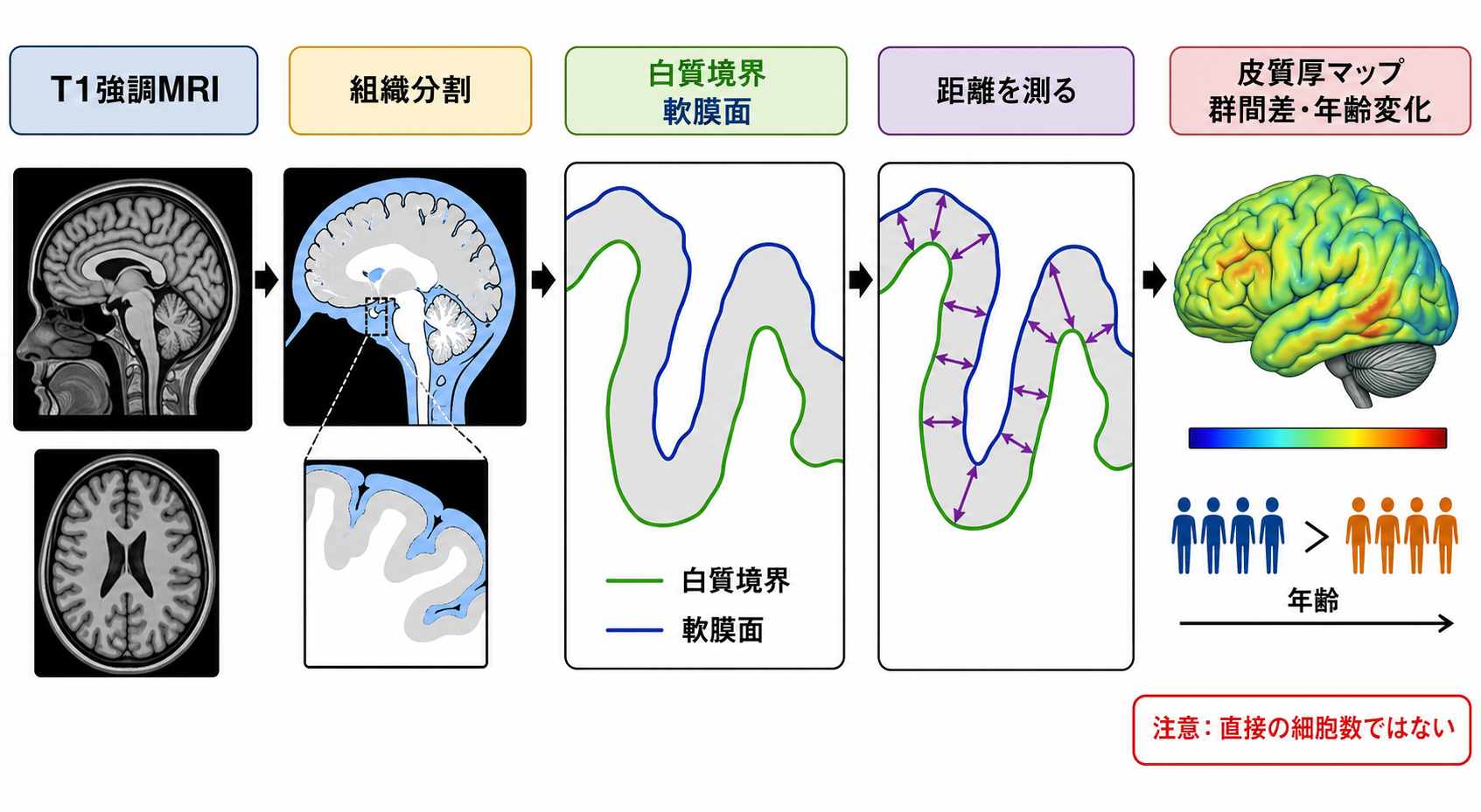 皮質厚を推定するメカニズム
