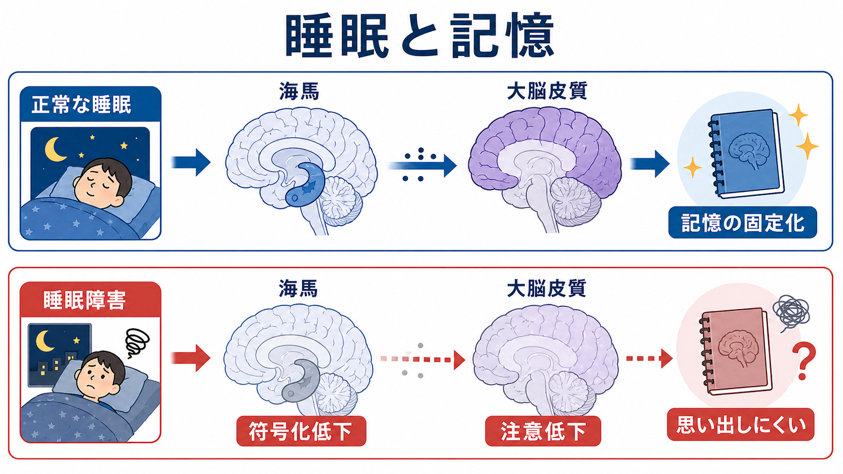 睡眠障害による記憶固定化と符号化低下