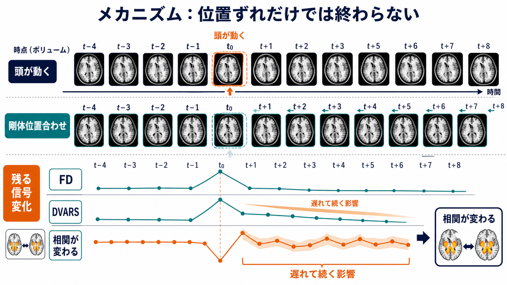 位置合わせ後にも残る頭動由来信号のメカニズム