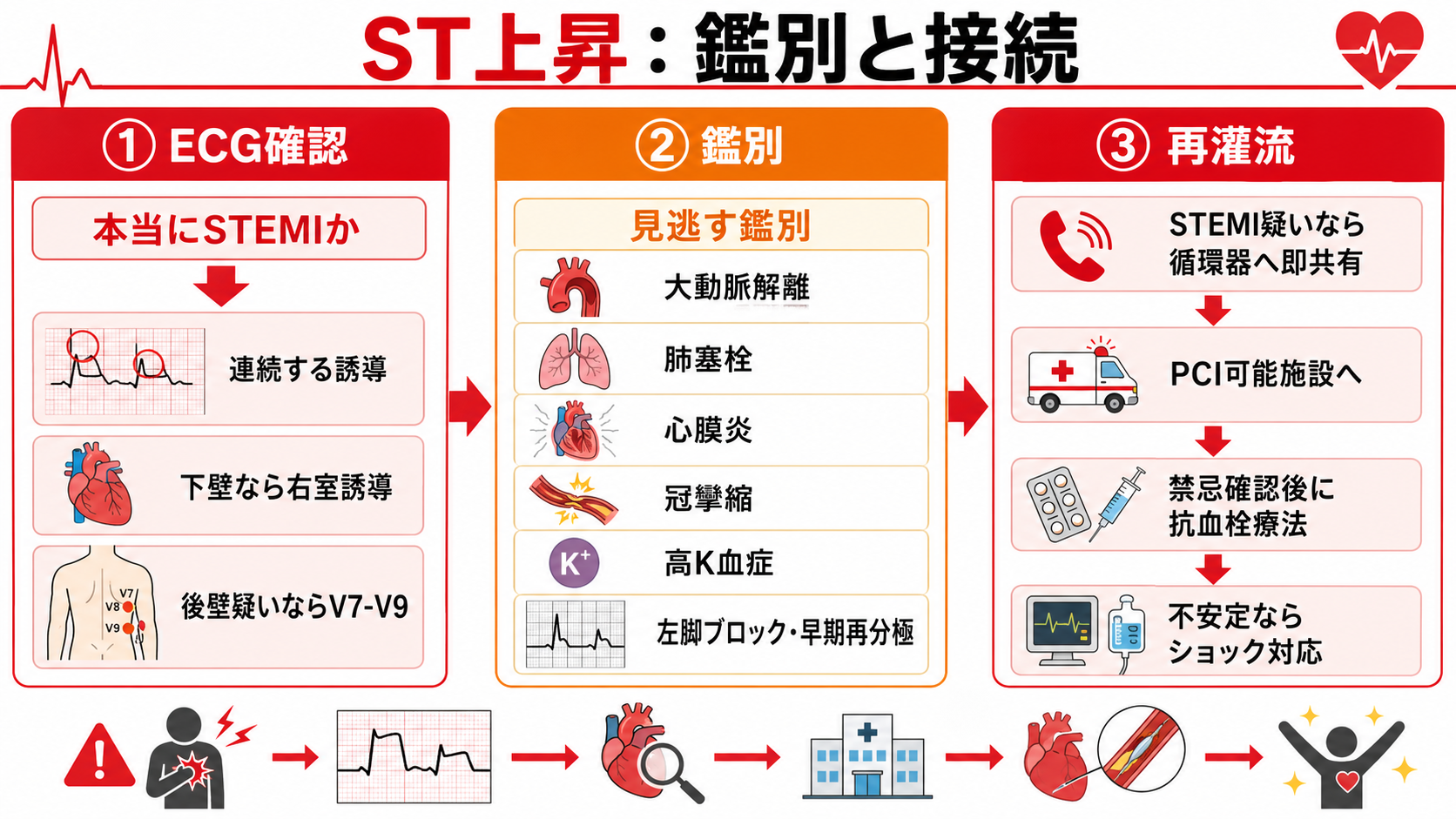 ST上昇の鑑別と接続