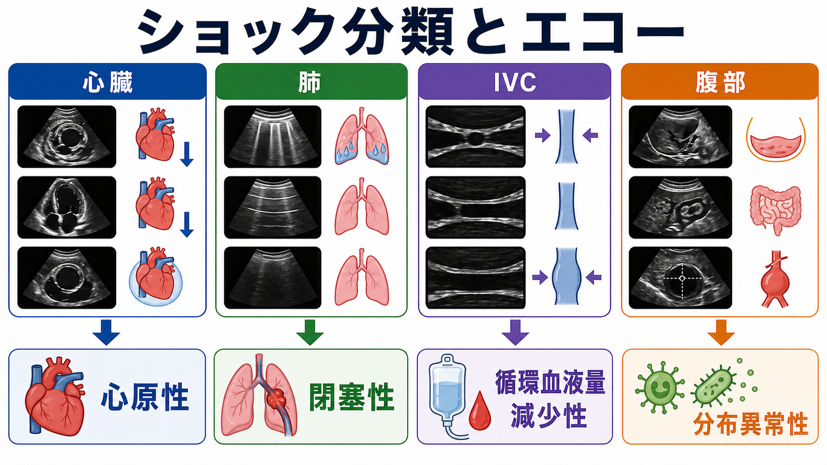 ショック分類をエコーで確認する流れ