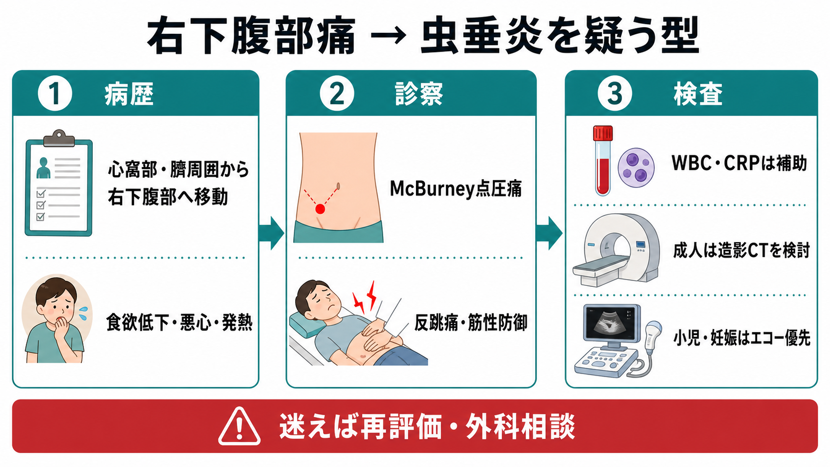 右下腹部痛で虫垂炎を疑う型