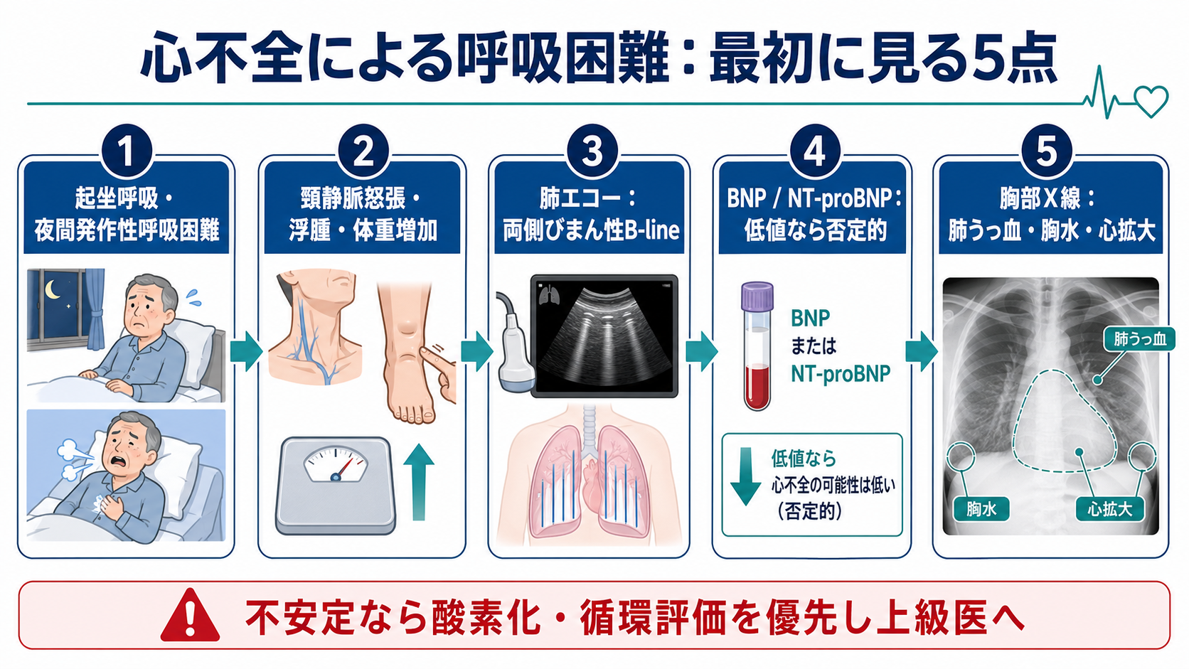 心不全による呼吸困難で最初に見る5点