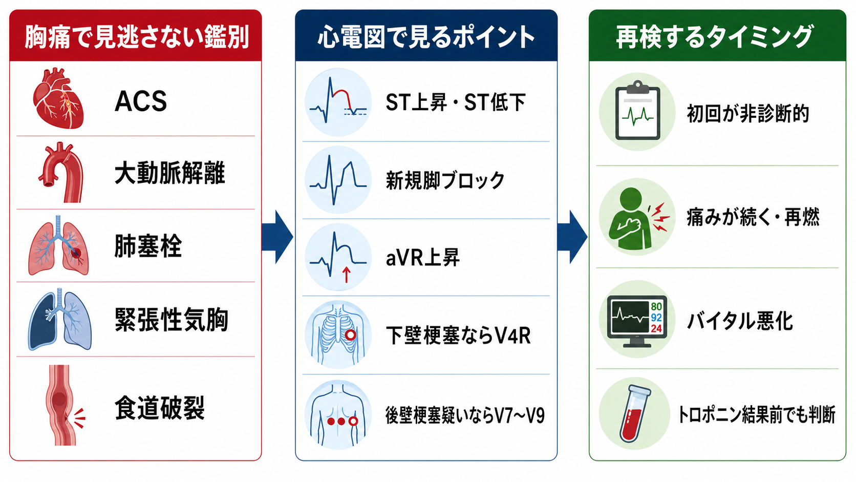 胸痛で見逃さない鑑別と心電図再検
