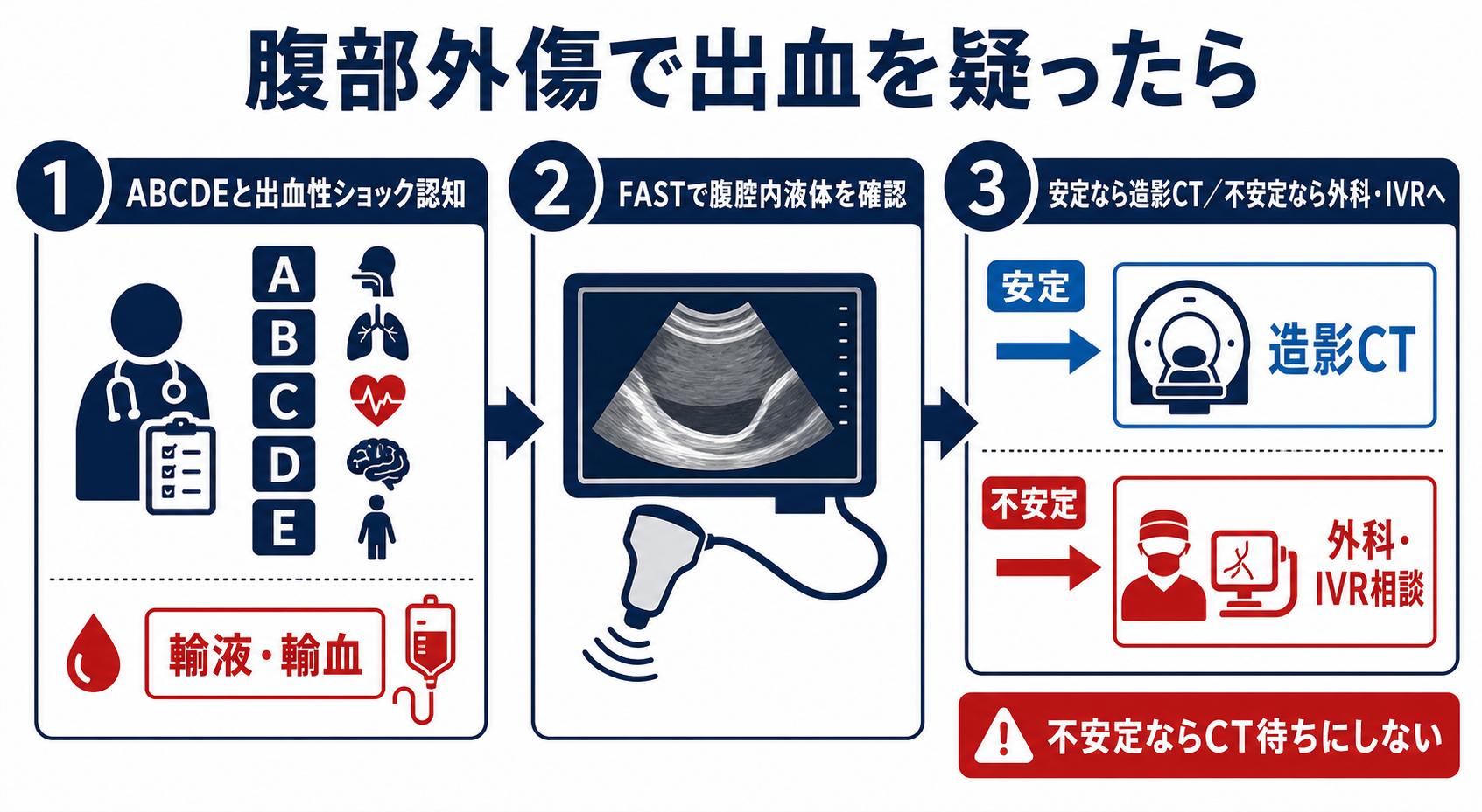 腹部外傷で出血を疑ったらの判断フロー
